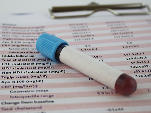 Hypocholesterolémia v intenzívnej starostlivosti