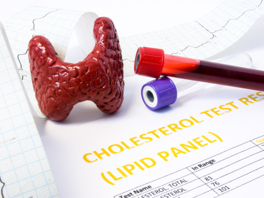 Hypocholesterolémia – máme se z nej radovať, alebo sa jej obávať?